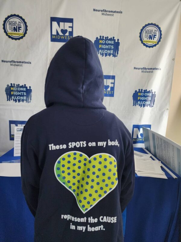 These Spots On My Back, Represent the CAUSE In My Heart - Hoodie